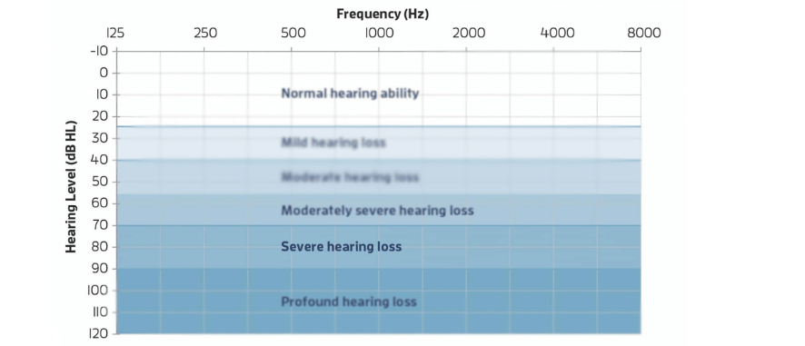 The Best Hearing Aids for Severe Hearing Loss | Aanvii Hearing The Best Hearing Aids for Severe Hearing Loss | Aanvii Hearing